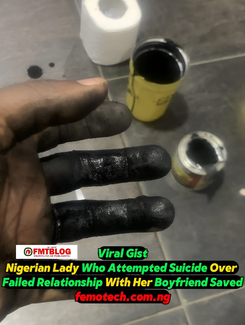 Nigerian Lady who attempted suicide
