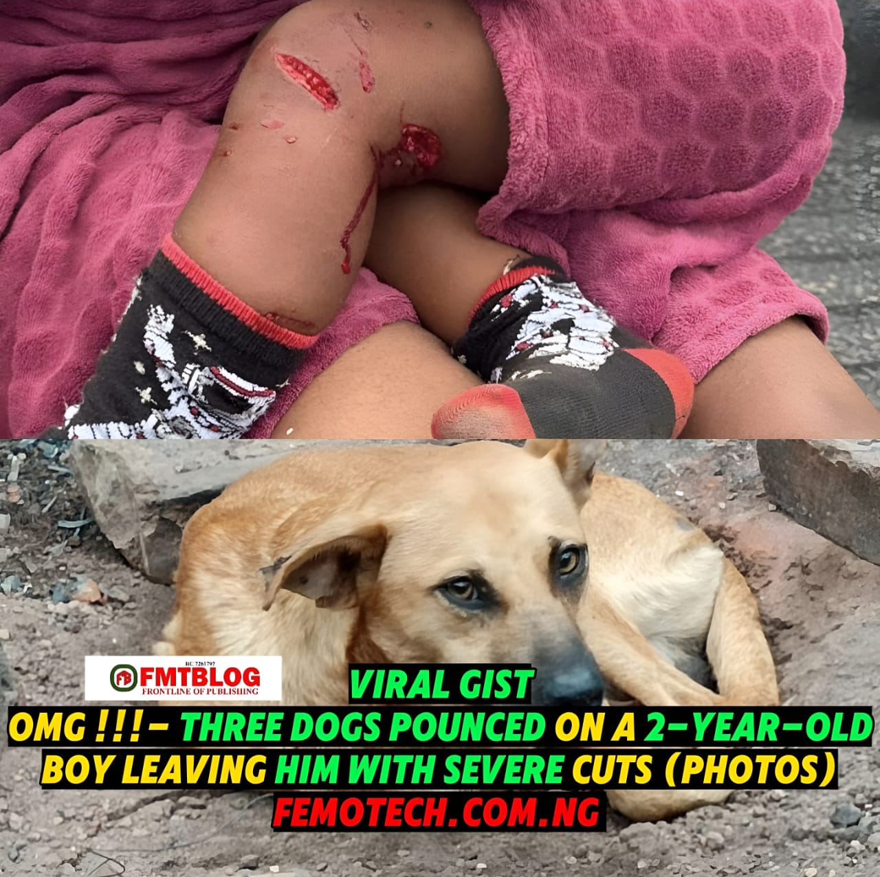 Three Dogs Pounced On A 2-Year-Old Boy