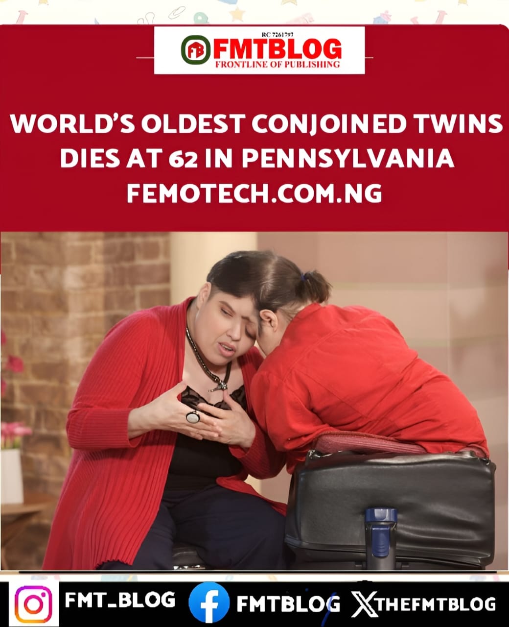 World's Oldest Conjoined Twins