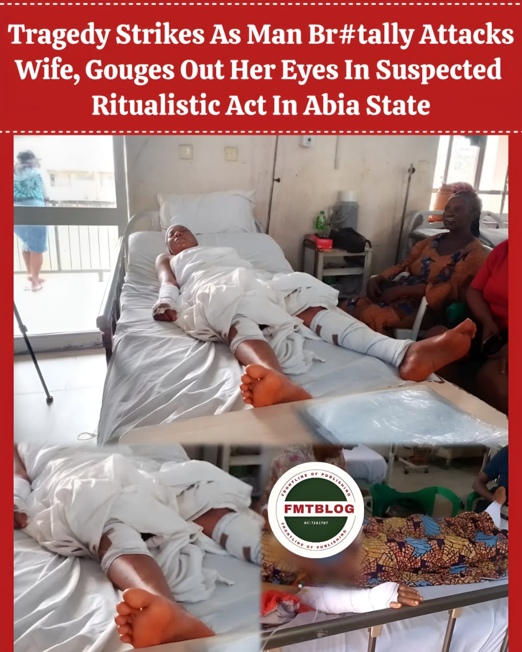 Tragedy Strikes As Man Brutally Attacks Wife, Gouges Out Her Eyes In Suspected Ritualistic Act In Abia State